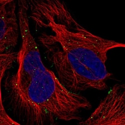 TMEM164 Antibody, Novus Biologicals:Antibodies:Primary Antibodies